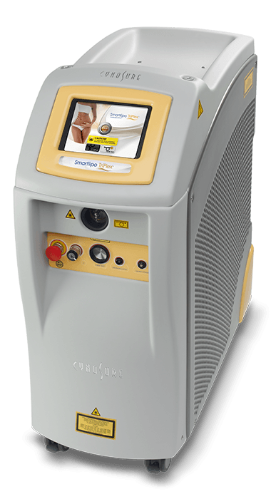 Smartlipo
