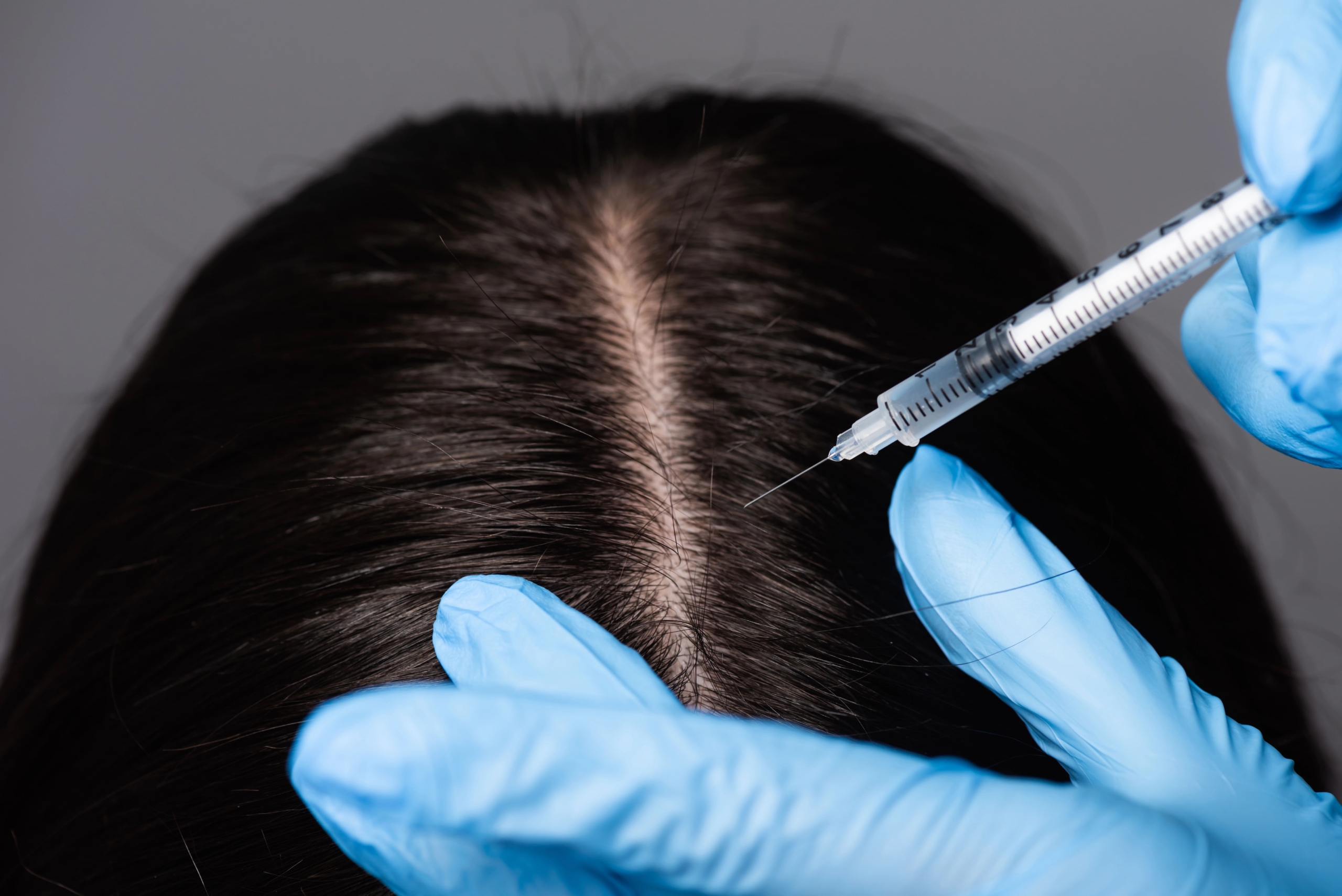 Amaira Med Spa, Hair Injection Ez Gel (1)