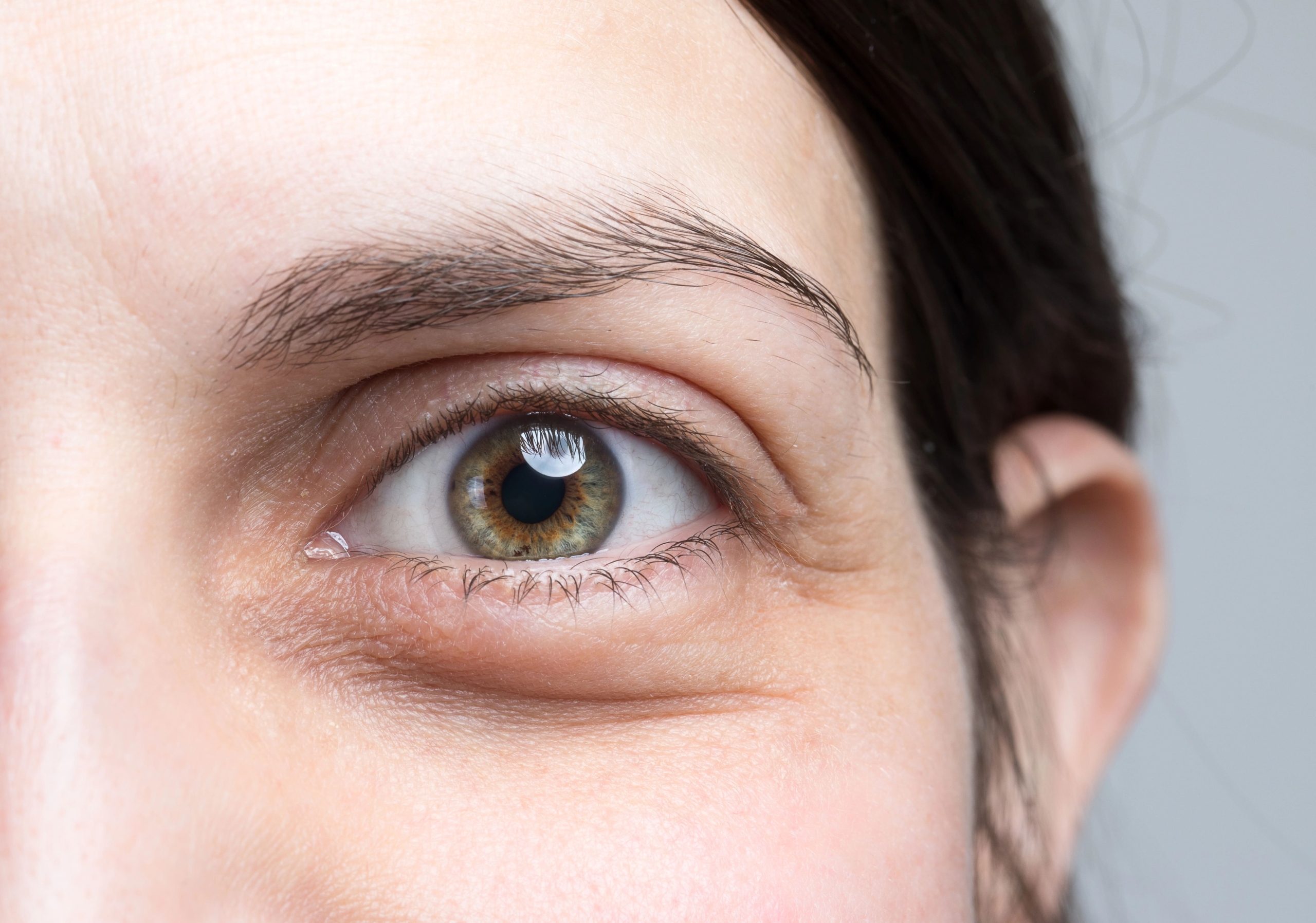 Amaira Med Spa, Under Eye V3 (1)