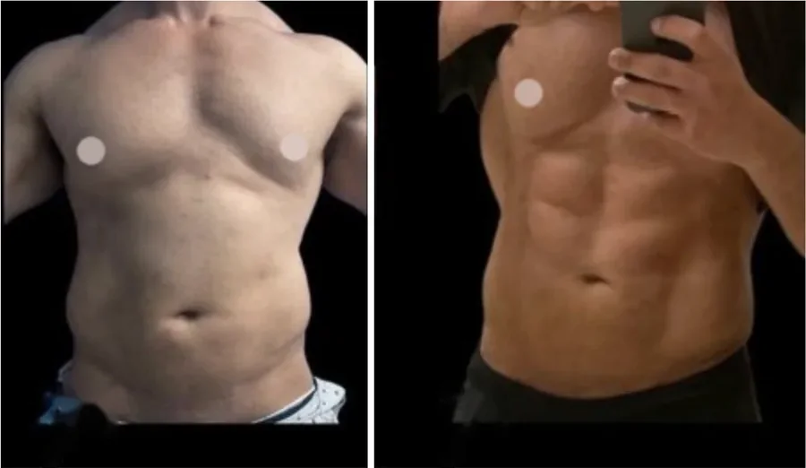 Ab Etching before and after